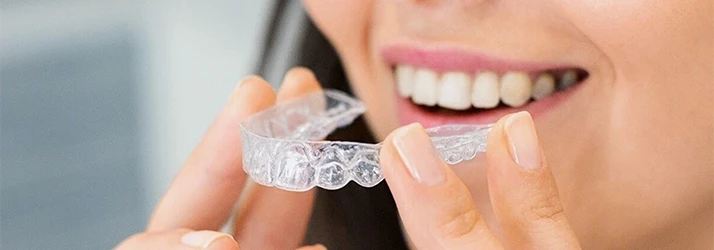 Invisalign Aligner